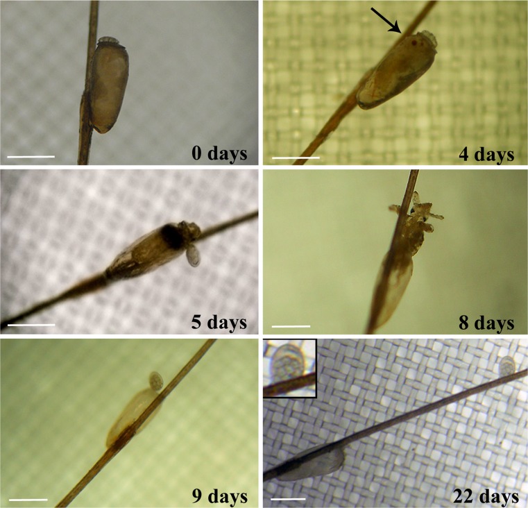 Proceso de maduración de larva de piojo